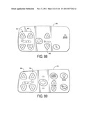 HOSPITAL BED diagram and image