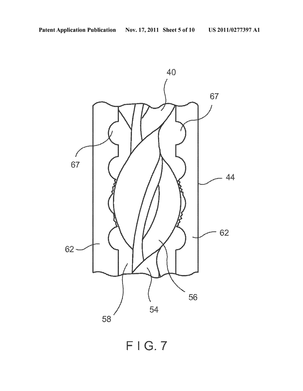 Restoration Anchoring System - diagram, schematic, and image 06