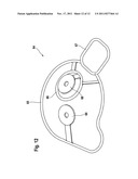 Motor-Pump Assembly diagram and image