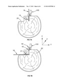 AN ANTI-BOUNCE DEVICE diagram and image