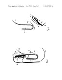 Side Airbag Installation in a Backrest of a Motor Vehicle Seat diagram and image