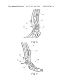 ADJUSTING DEVICE FOR ADJUSTING A BACKREST OF A VEHICLE SEAT diagram and image