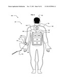 Wearable power-output device operable to deliver wirelessly received power diagram and image