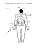 Wearable power-output device operable to deliver wirelessly received power diagram and image