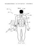 Wearable power-output device operable to deliver wirelessly received power diagram and image