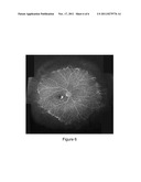 SYSTEMS AND METHODS FOR WIDEFIELD MAPPING OF THE RETINA diagram and image