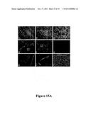 METHODS AND COMPOSITIONS FOR THE DETECTION AND TREATMENT OF PREECLAMPSIA diagram and image