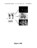 METHODS AND COMPOSITIONS FOR THE DETECTION AND TREATMENT OF PREECLAMPSIA diagram and image