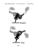 DRUG SELECTION FOR GASTRIC CANCER THERAPY USING ANTIBODY-BASED ARRAYS diagram and image