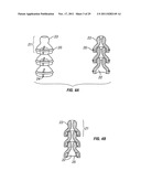 SHAPE-TRANSFERRING CANNULA SYSTEM AND METHOD OF USE diagram and image