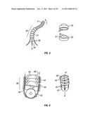 SHAPE-TRANSFERRING CANNULA SYSTEM AND METHOD OF USE diagram and image