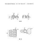 SHAPE-TRANSFERRING CANNULA SYSTEM AND METHOD OF USE diagram and image