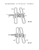 SHAPE-TRANSFERRING CANNULA SYSTEM AND METHOD OF USE diagram and image