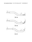 SHAPE-TRANSFERRING CANNULA SYSTEM AND METHOD OF USE diagram and image