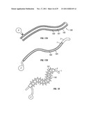 SHAPE-TRANSFERRING CANNULA SYSTEM AND METHOD OF USE diagram and image