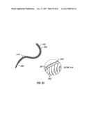 SHAPE-TRANSFERRING CANNULA SYSTEM AND METHOD OF USE diagram and image