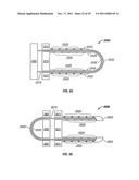 SHAPE-TRANSFERRING CANNULA SYSTEM AND METHOD OF USE diagram and image