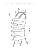 SHAPE-TRANSFERRING CANNULA SYSTEM AND METHOD OF USE diagram and image