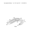 SHAPE-TRANSFERRING CANNULA SYSTEM AND METHOD OF USE diagram and image