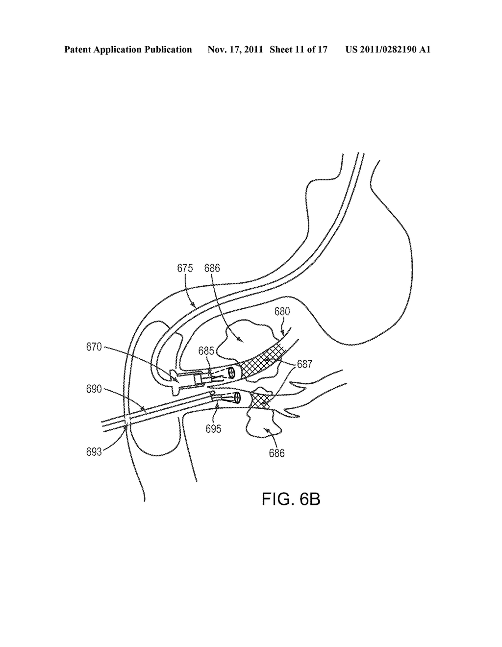 COMBINED ENDOSCOPIC SURGICAL TOOLS - diagram, schematic, and image 12