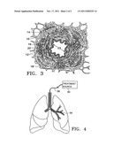 METHODS OF EVALUATING INDIVIDUALS HAVING REVERSIBLE OBSTRUCTIVE PULMONARY     DISEASE diagram and image