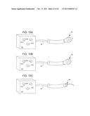 Methods and Systems for Delivery of Acoustic Energy to Tissue Surfaces,     Cavities and Obstructed Passages such as Intranasal Ostia diagram and image