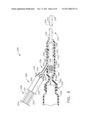 Instrument for Debriding Tissue and Applying Therapeutic Cells diagram and image