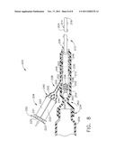 Instrument for Debriding Tissue and Applying Therapeutic Cells diagram and image