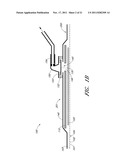 WOUND DRESSING AND METHOD OF USE diagram and image