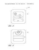 WOUND DRESSING AND METHOD OF USE diagram and image