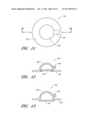 WOUND DRESSING AND METHOD OF USE diagram and image