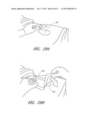 WOUND DRESSING AND METHOD OF USE diagram and image