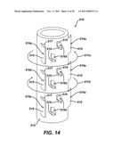 Instrument for Debriding Fistula and Applying Therapeutic Cells diagram and image