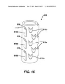 Instrument for Debriding Fistula and Applying Therapeutic Cells diagram and image