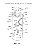 Instrument for Debriding Fistula and Applying Therapeutic Cells diagram and image