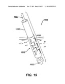 Instrument for Debriding Fistula and Applying Therapeutic Cells diagram and image