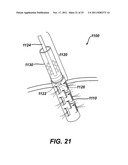 Instrument for Debriding Fistula and Applying Therapeutic Cells diagram and image