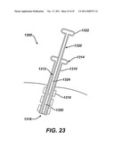 Instrument for Debriding Fistula and Applying Therapeutic Cells diagram and image