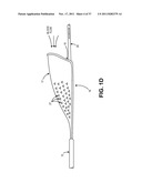 Intravascular Blood Filters and Methods of Use diagram and image