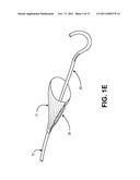 Intravascular Blood Filters and Methods of Use diagram and image