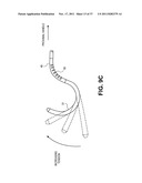 Intravascular Blood Filters and Methods of Use diagram and image