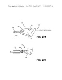 Intravascular Blood Filters and Methods of Use diagram and image