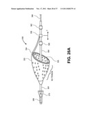 Intravascular Blood Filters and Methods of Use diagram and image