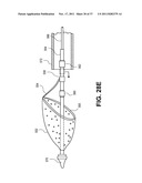 Intravascular Blood Filters and Methods of Use diagram and image