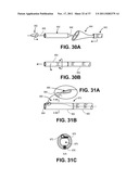 Intravascular Blood Filters and Methods of Use diagram and image