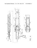 Therapeutic Cell Applicator Instrument with Modular Tips diagram and image