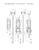 Therapeutic Cell Applicator Instrument with Modular Tips diagram and image