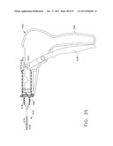 Therapeutic Cell Applicator Instrument with Modular Tips diagram and image