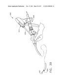 Therapeutic Cell Applicator Instrument with Modular Tips diagram and image