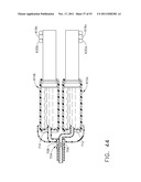 Therapeutic Cell Applicator Instrument with Modular Tips diagram and image